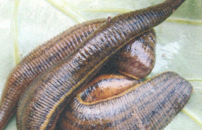 30 Traumdeutungen von Blutegeln